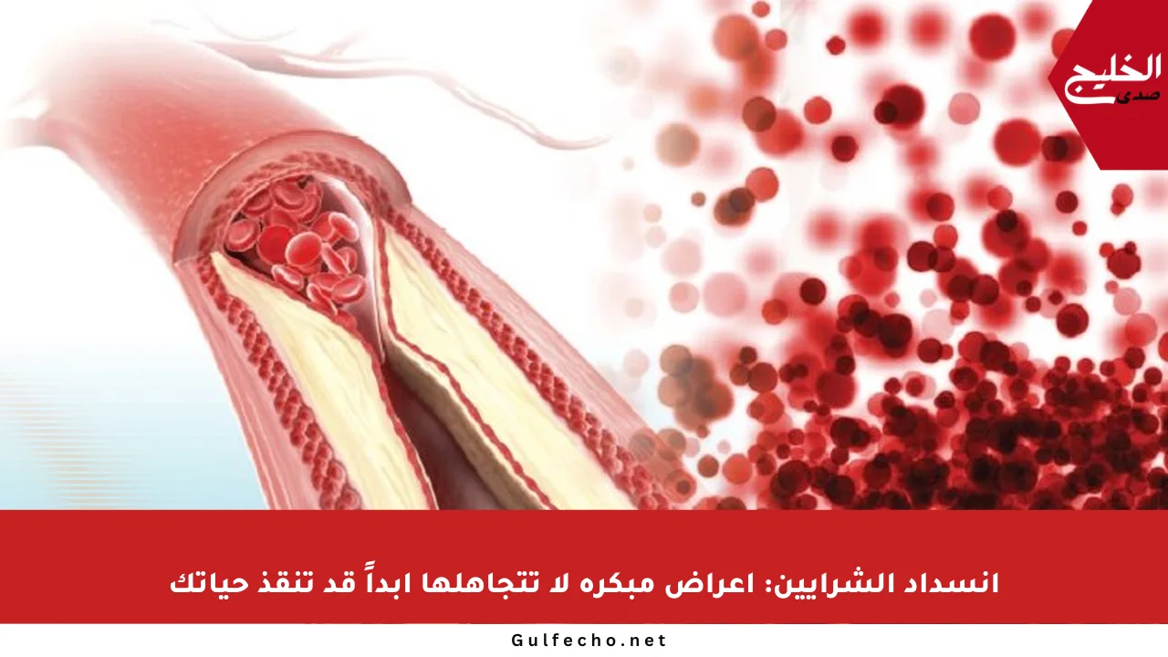 انسداد الشرايين: أعراض مبكرة لا تتجاهلها أبداً قد تنقذ حياتك